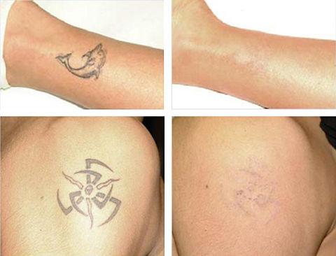 Dariro Tattoo - Photo 3